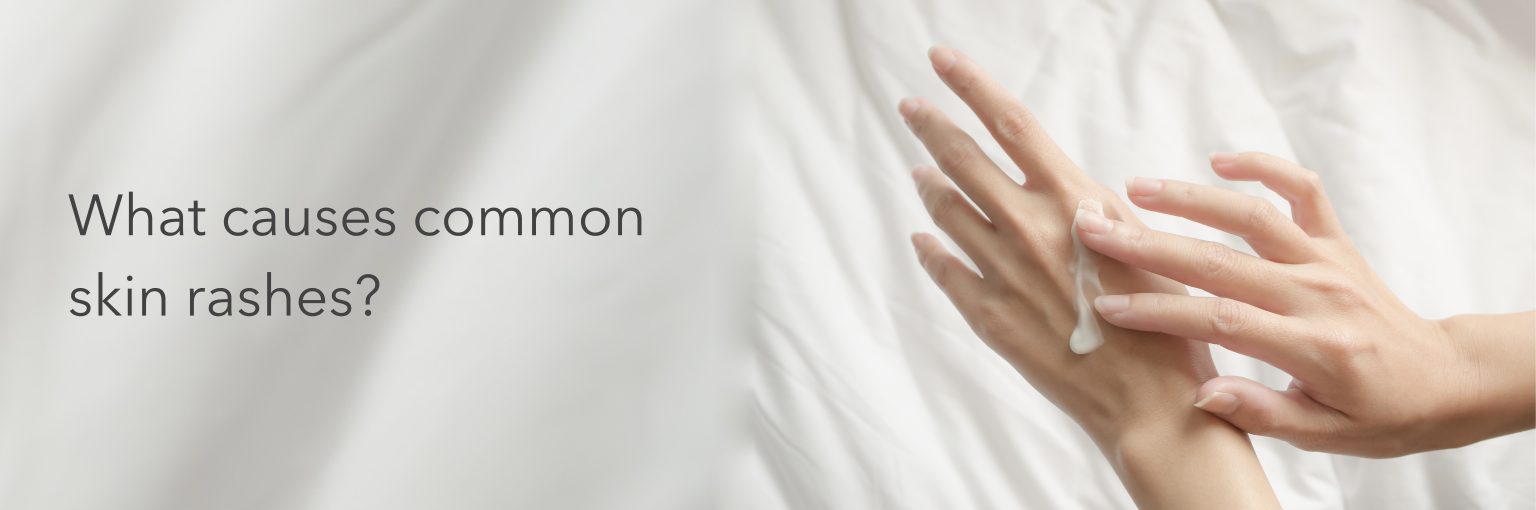 What causes common skin rashes? - Dermikelp South Africa